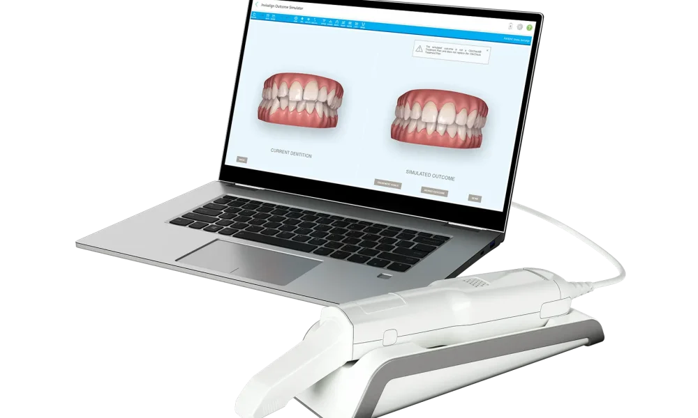 じろうまる歯科室の歯科矯正で使用している3DスキャナーのiTero